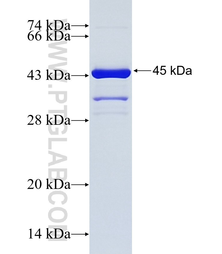 PHF20L1 fusion protein Ag25838 SDS-PAGE PHF20L1 fusion protein Ag25838 SDS-PAGE