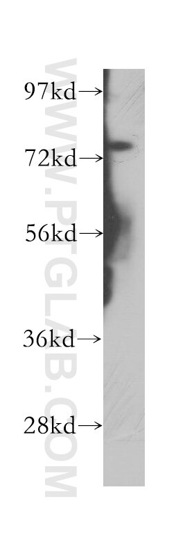 Western Blot (WB) analysis of HEK-293 cells using PHF21A Polyclonal antibody (12127-1-AP)