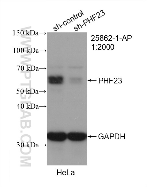 Western Blot (WB) analysis of HeLa cells using PHF23 Polyclonal antibody (25862-1-AP)