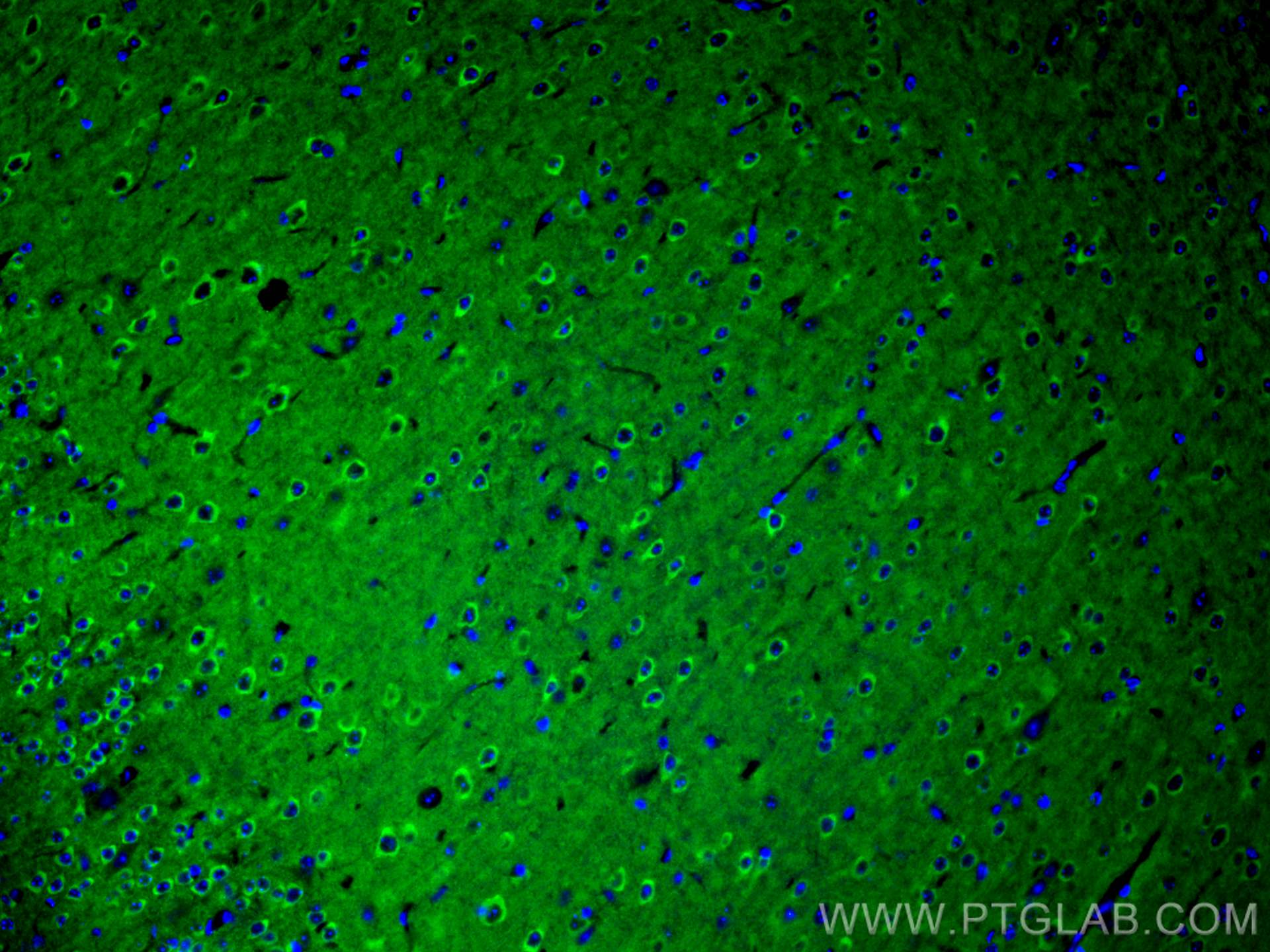 Immunofluorescence (IF) / fluorescent staining of mouse brain tissue using PHF24 Polyclonal antibody (27959-1-AP)