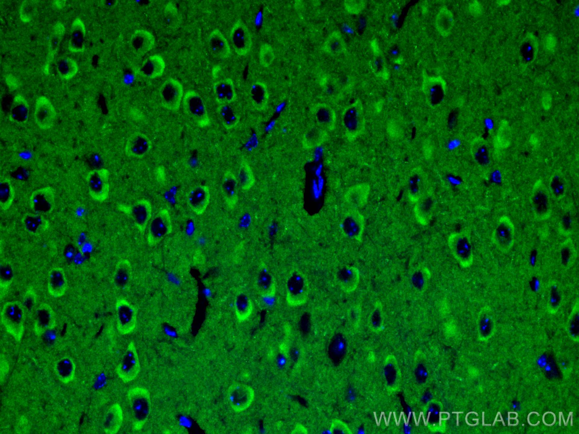 Immunofluorescence (IF) / fluorescent staining of mouse brain tissue using PHF24 Polyclonal antibody (27959-1-AP)