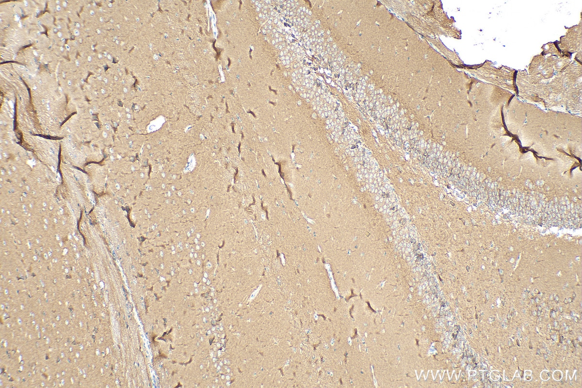 Immunohistochemistry (IHC) staining of mouse brain tissue using PHF24 Polyclonal antibody (27959-1-AP)