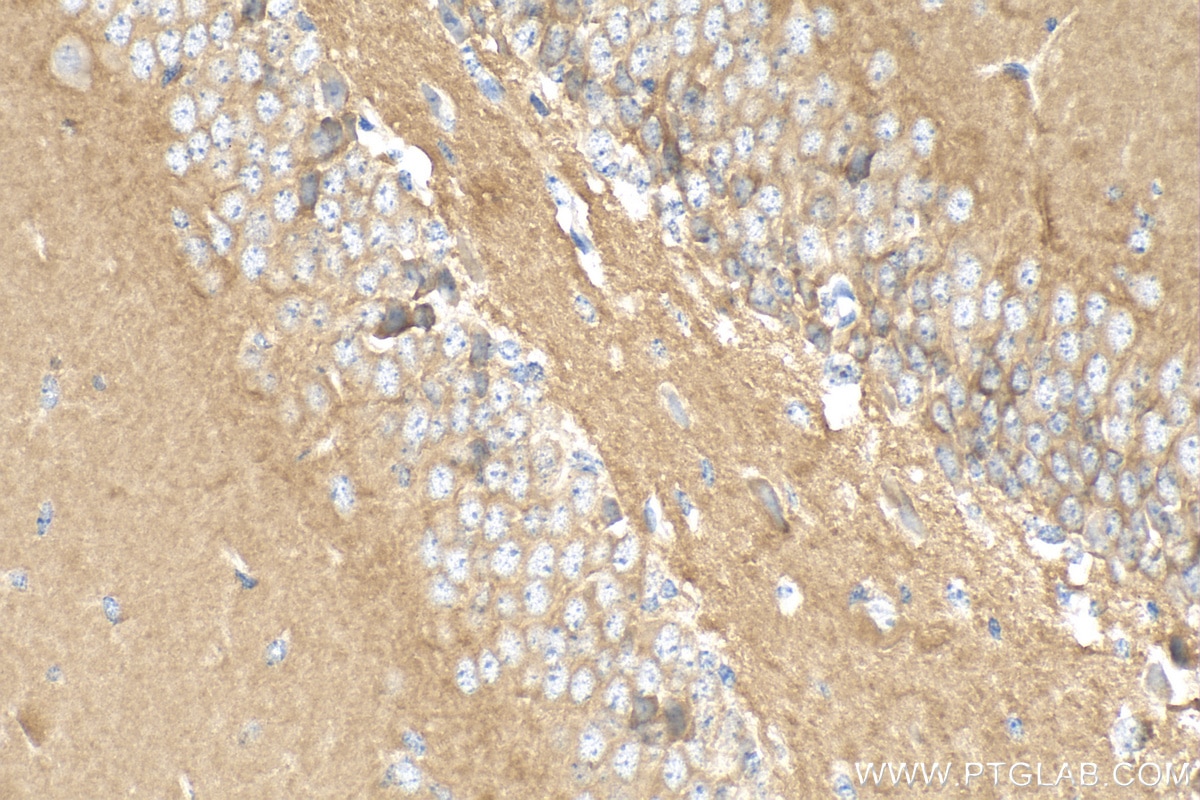 Immunohistochemistry (IHC) staining of mouse brain tissue using PHF24 Polyclonal antibody (27959-1-AP)