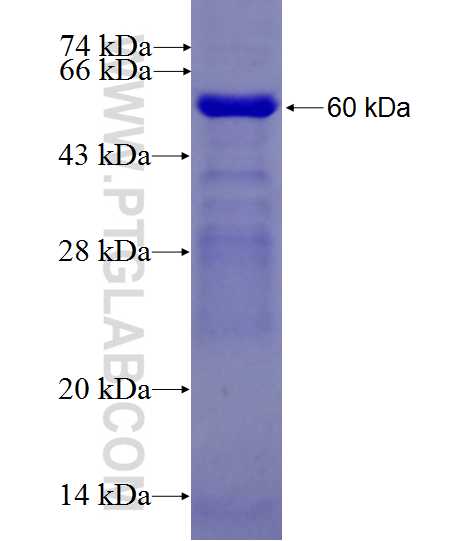 PHF24 fusion protein Ag27492 SDS-PAGE