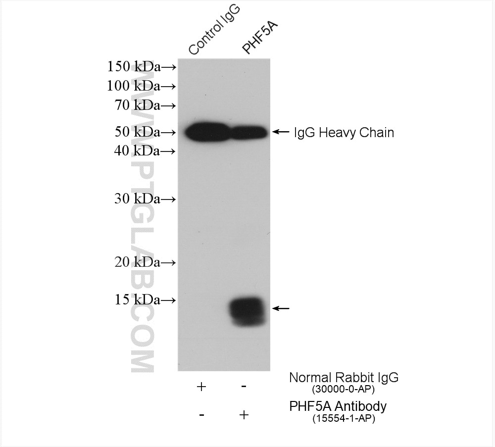 Immunoprecipitation (IP) experiment of HeLa cells using PHF5A Polyclonal antibody (15554-1-AP)