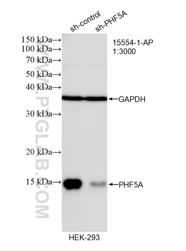 Western Blot (WB) analysis of HEK-293 cells using PHF5A Polyclonal antibody (15554-1-AP)