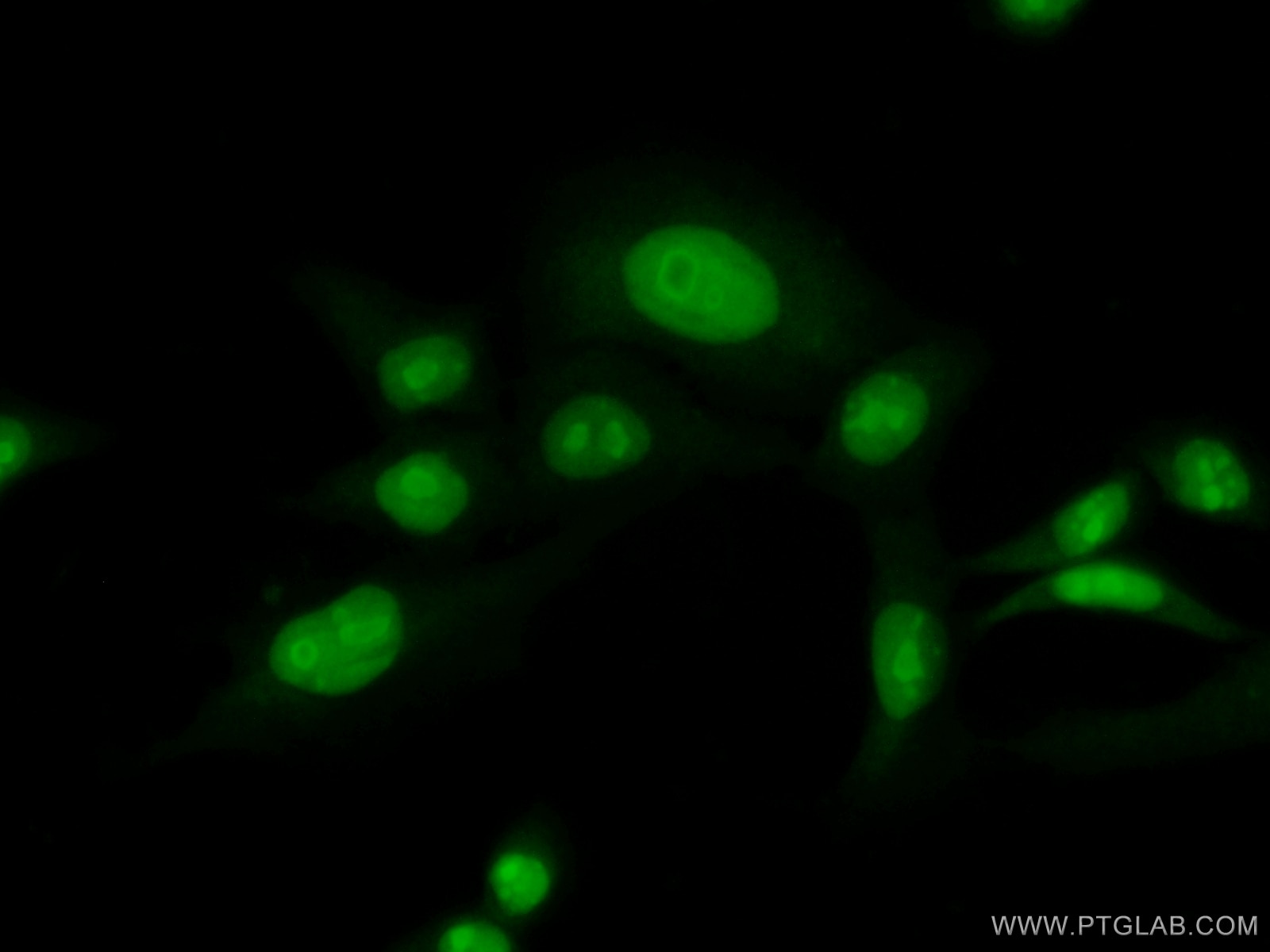 Immunofluorescence (IF) / fluorescent staining of HeLa cells using PHF6 Polyclonal antibody (51062-1-AP)
