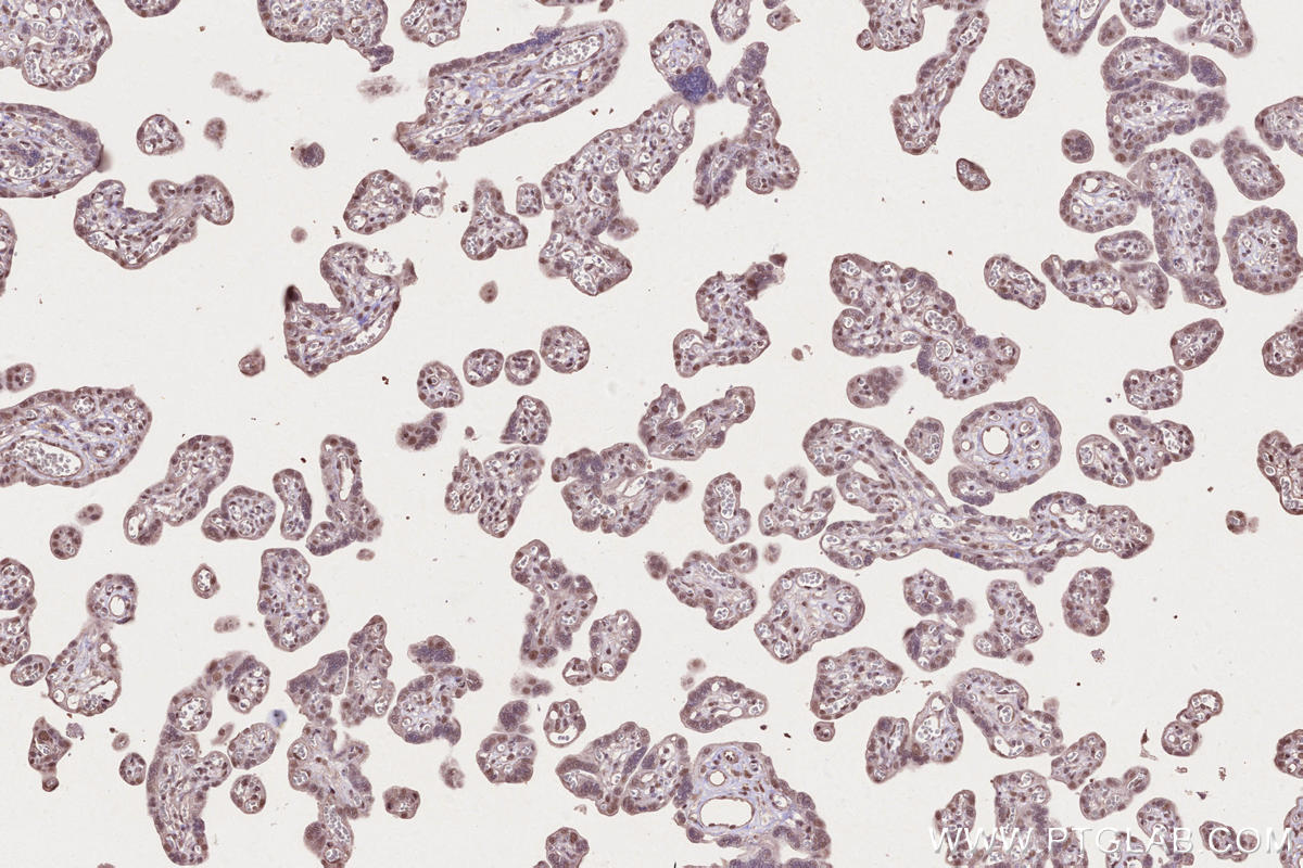 Immunohistochemistry (IHC) staining of human placenta tissue using PHF6 Polyclonal antibody (51062-1-AP)