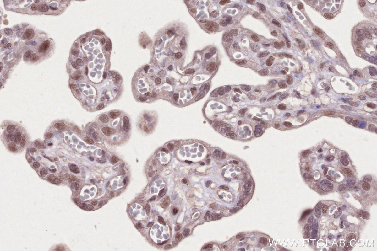 Immunohistochemistry (IHC) staining of human placenta tissue using PHF6 Polyclonal antibody (51062-1-AP)