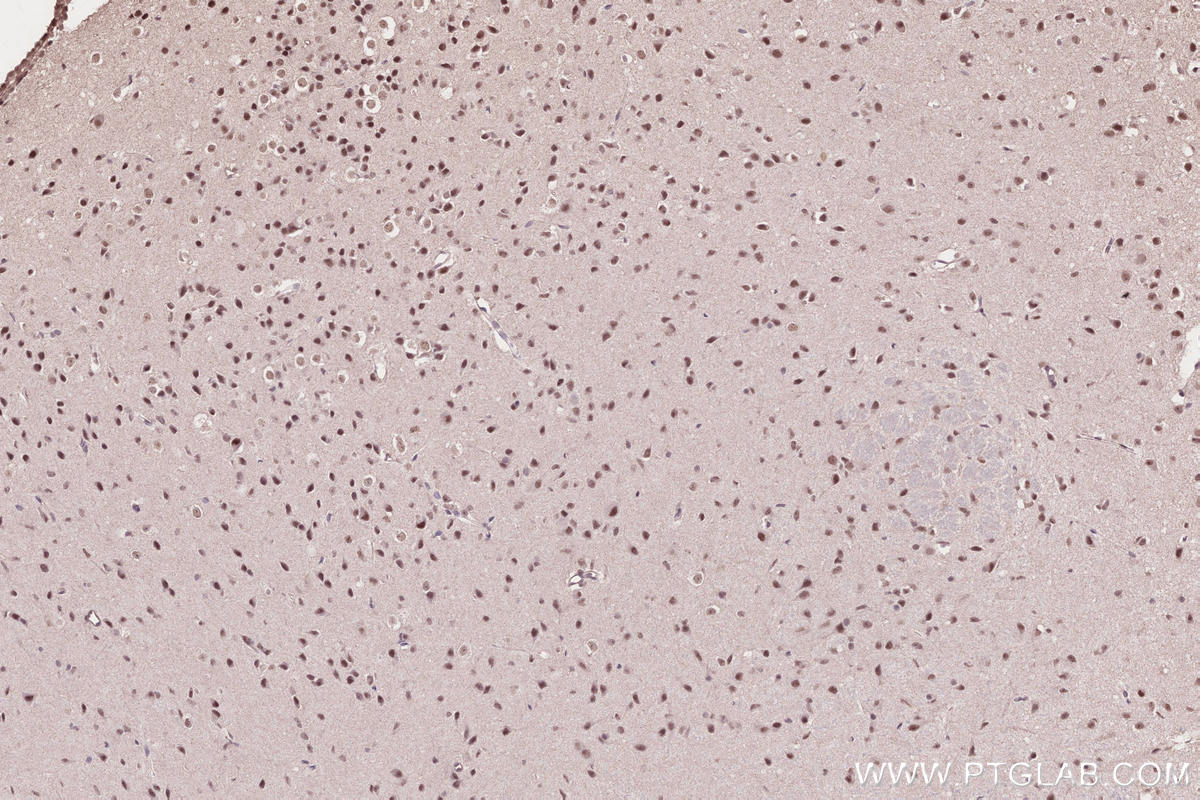Immunohistochemistry (IHC) staining of mouse brain tissue using PHF6 Polyclonal antibody (51062-1-AP)