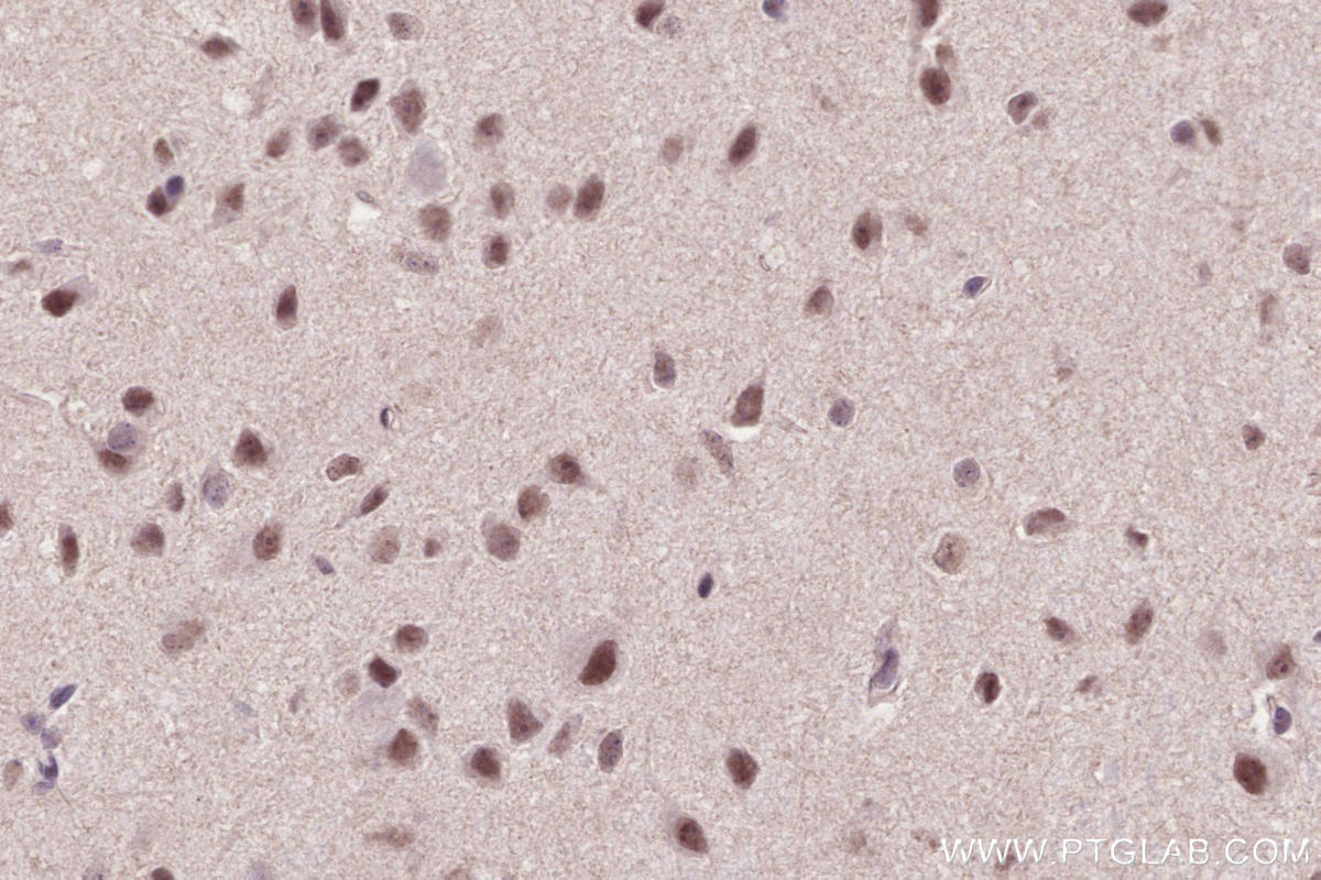 Immunohistochemistry (IHC) staining of mouse brain tissue using PHF6 Polyclonal antibody (51062-1-AP)