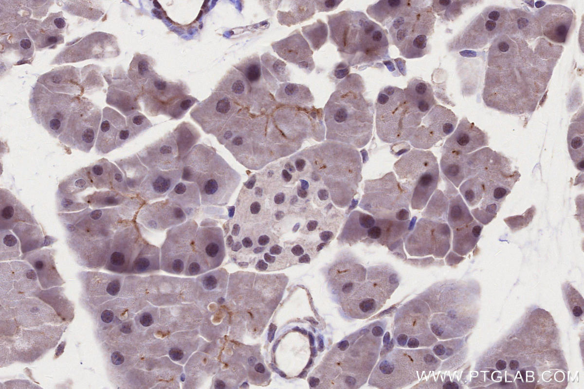 Immunohistochemistry (IHC) staining of mouse stomach tissue using PHF6 Polyclonal antibody (51062-1-AP)