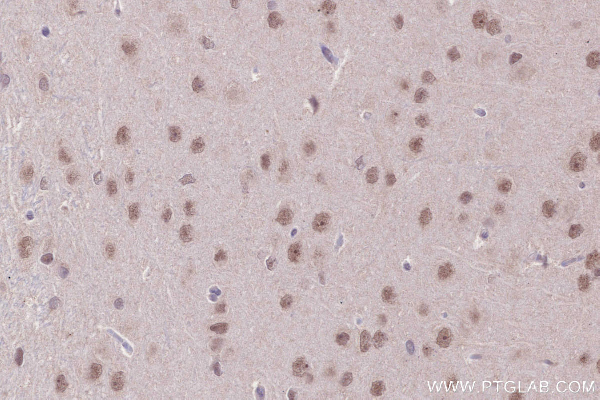Immunohistochemistry (IHC) staining of rat brain tissue using PHF6 Polyclonal antibody (51062-1-AP)