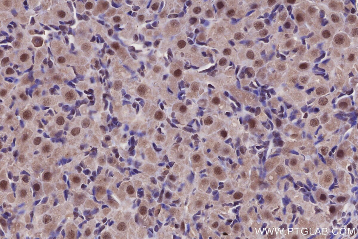 Immunohistochemistry (IHC) staining of rat ovary tissue using PHF6 Polyclonal antibody (51062-1-AP)