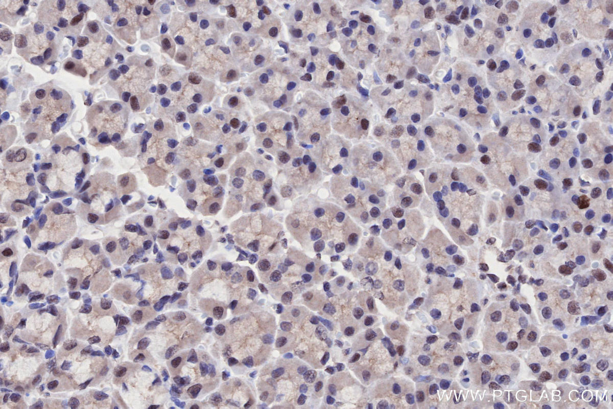 Immunohistochemistry (IHC) staining of rat stomach tissue using PHF6 Polyclonal antibody (51062-1-AP)