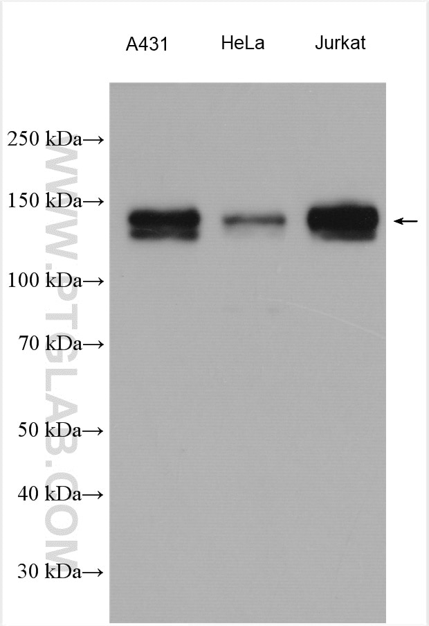Western Blot (WB) analysis of various lysates using PHF8 Polyclonal antibody (29516-1-AP)