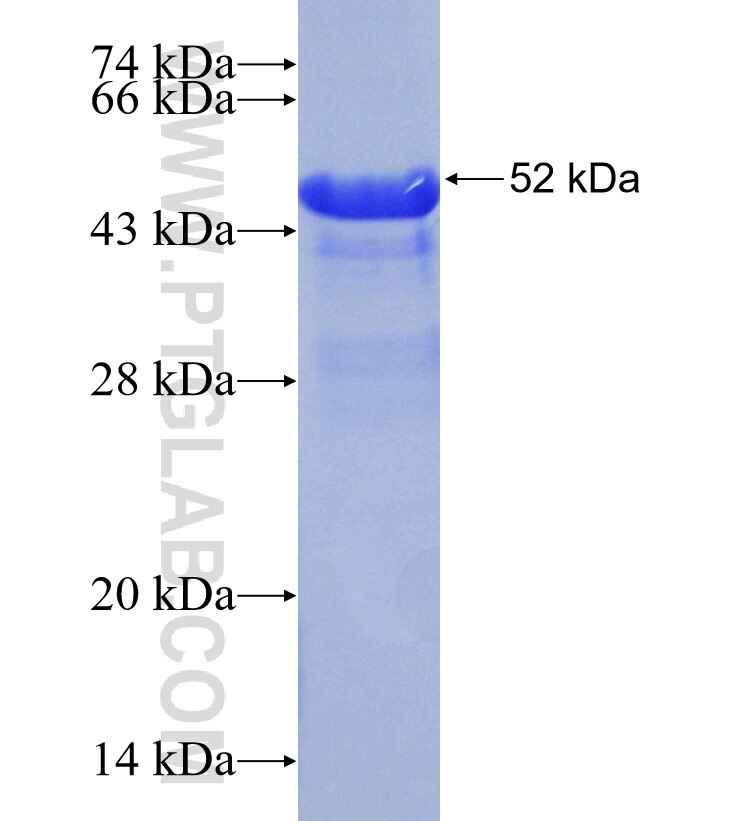 PHF8 fusion protein Ag30701 SDS-PAGE