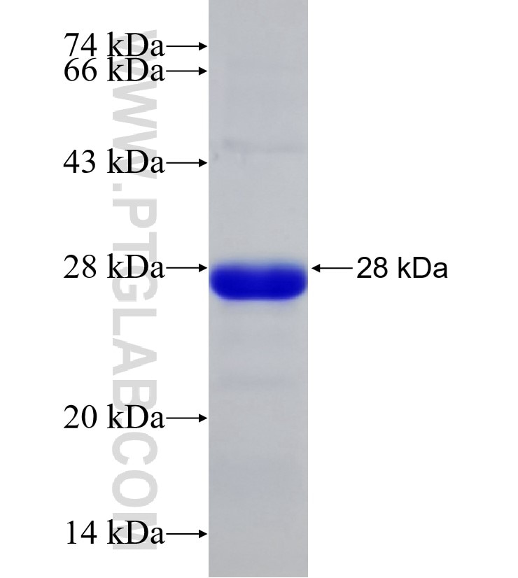 PHF8 fusion protein Ag30714 SDS-PAGE