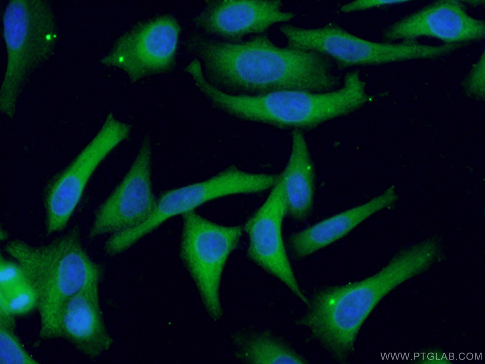 Immunofluorescence (IF) / fluorescent staining of HeLa cells using PHGDH Polyclonal antibody (14719-1-AP)