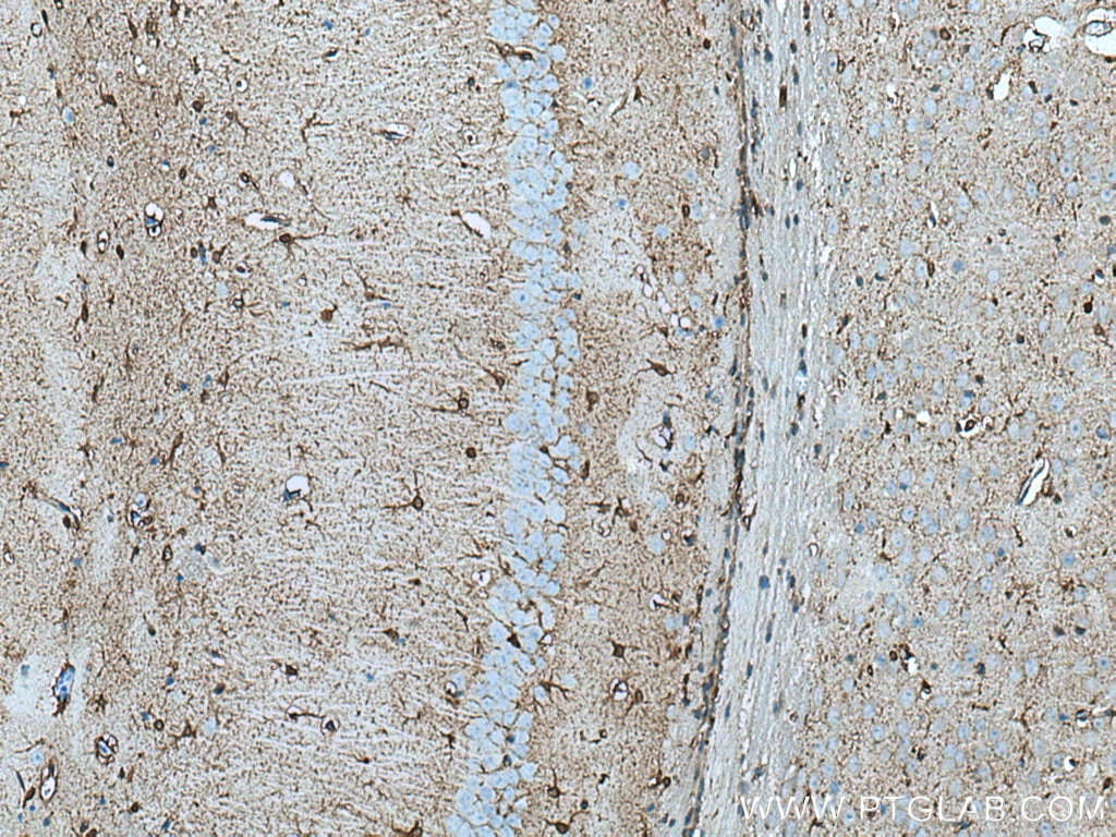 Immunohistochemistry (IHC) staining of mouse brain tissue using PHGDH Polyclonal antibody (14719-1-AP)