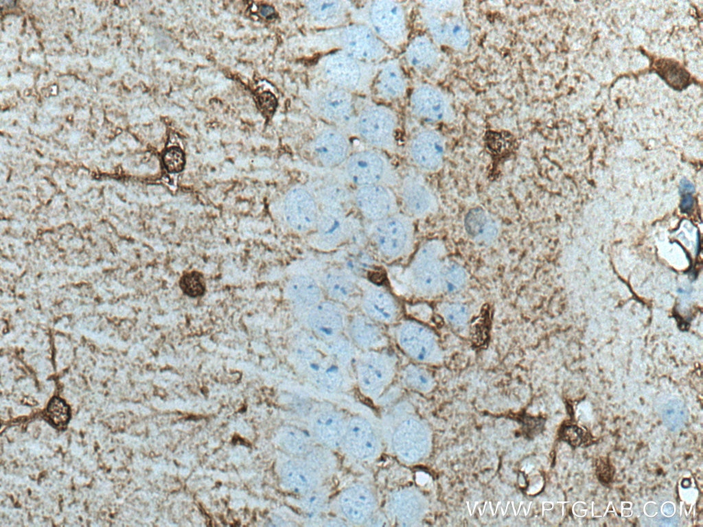 Immunohistochemistry (IHC) staining of mouse brain tissue using PHGDH Polyclonal antibody (14719-1-AP)