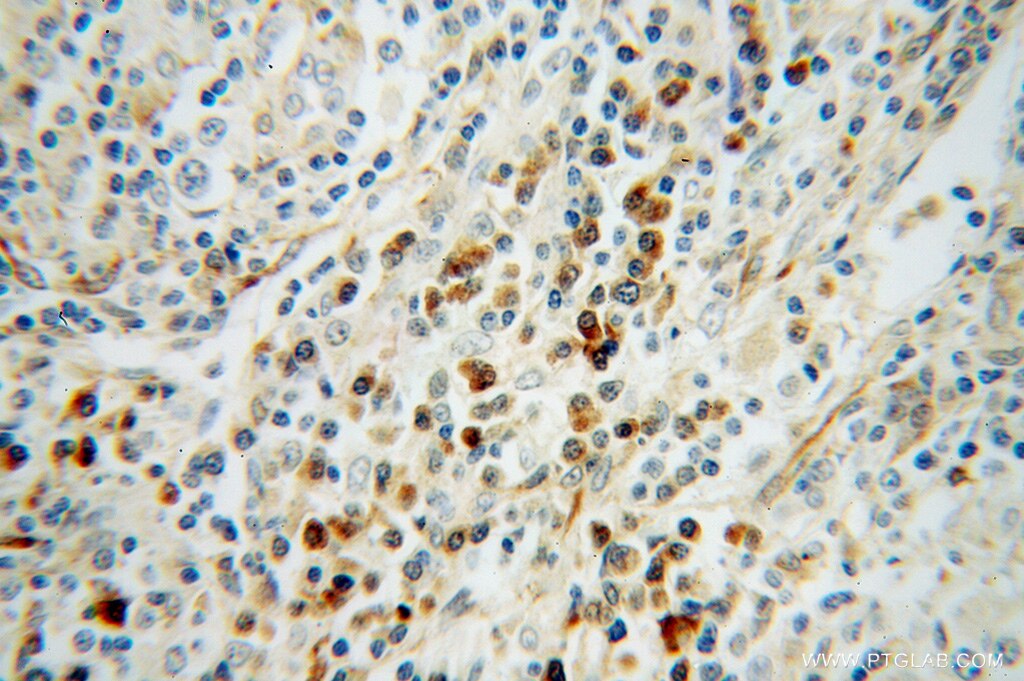 PHGDH Polyclonal antibody