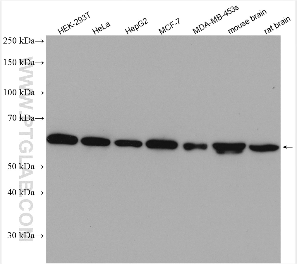 Western Blot (WB) analysis of various lysates using PHGDH Polyclonal antibody (14719-1-AP)