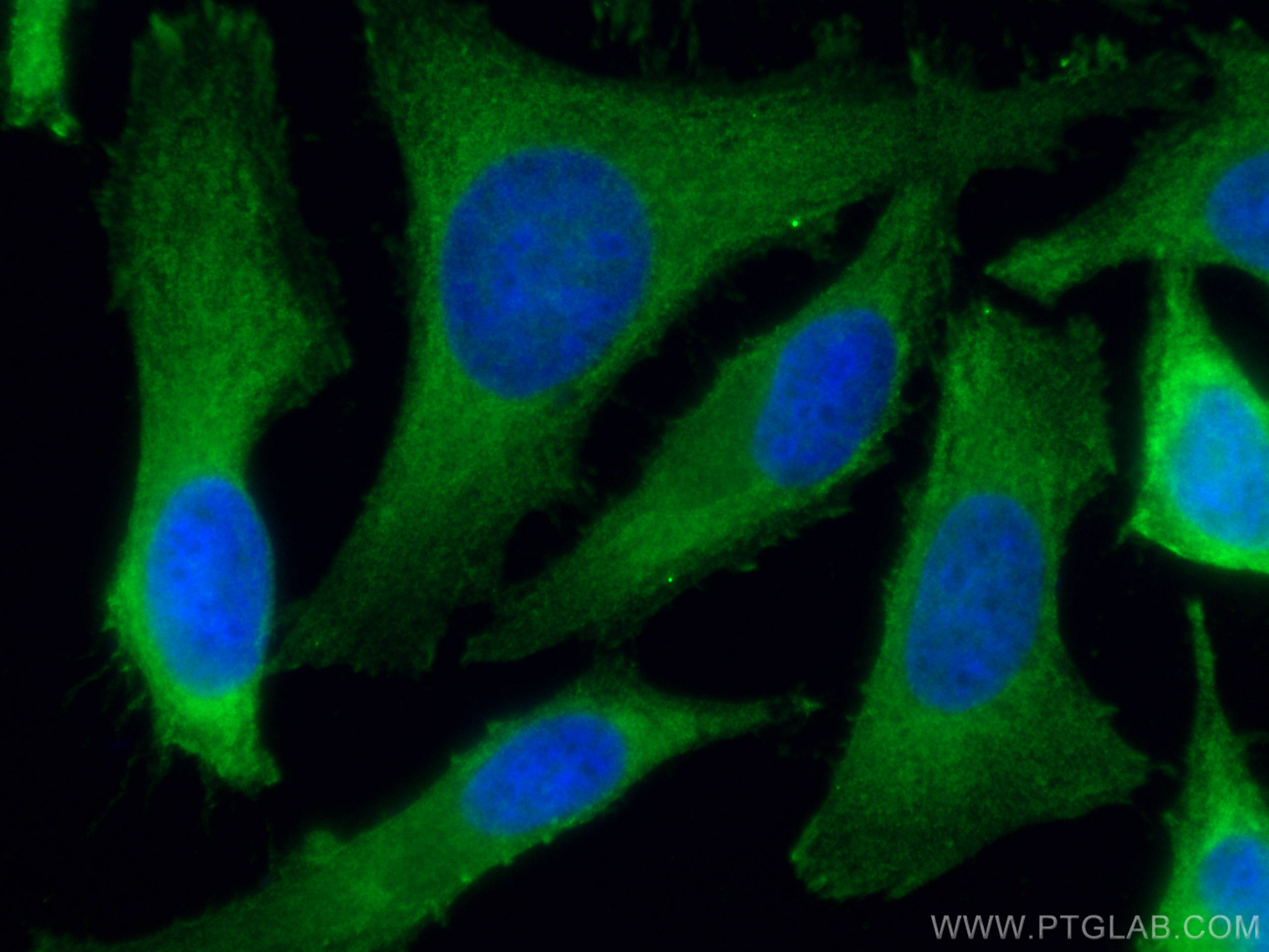 Immunofluorescence (IF) / fluorescent staining of HeLa cells using PHGDH Monoclonal antibody (67591-1-Ig)