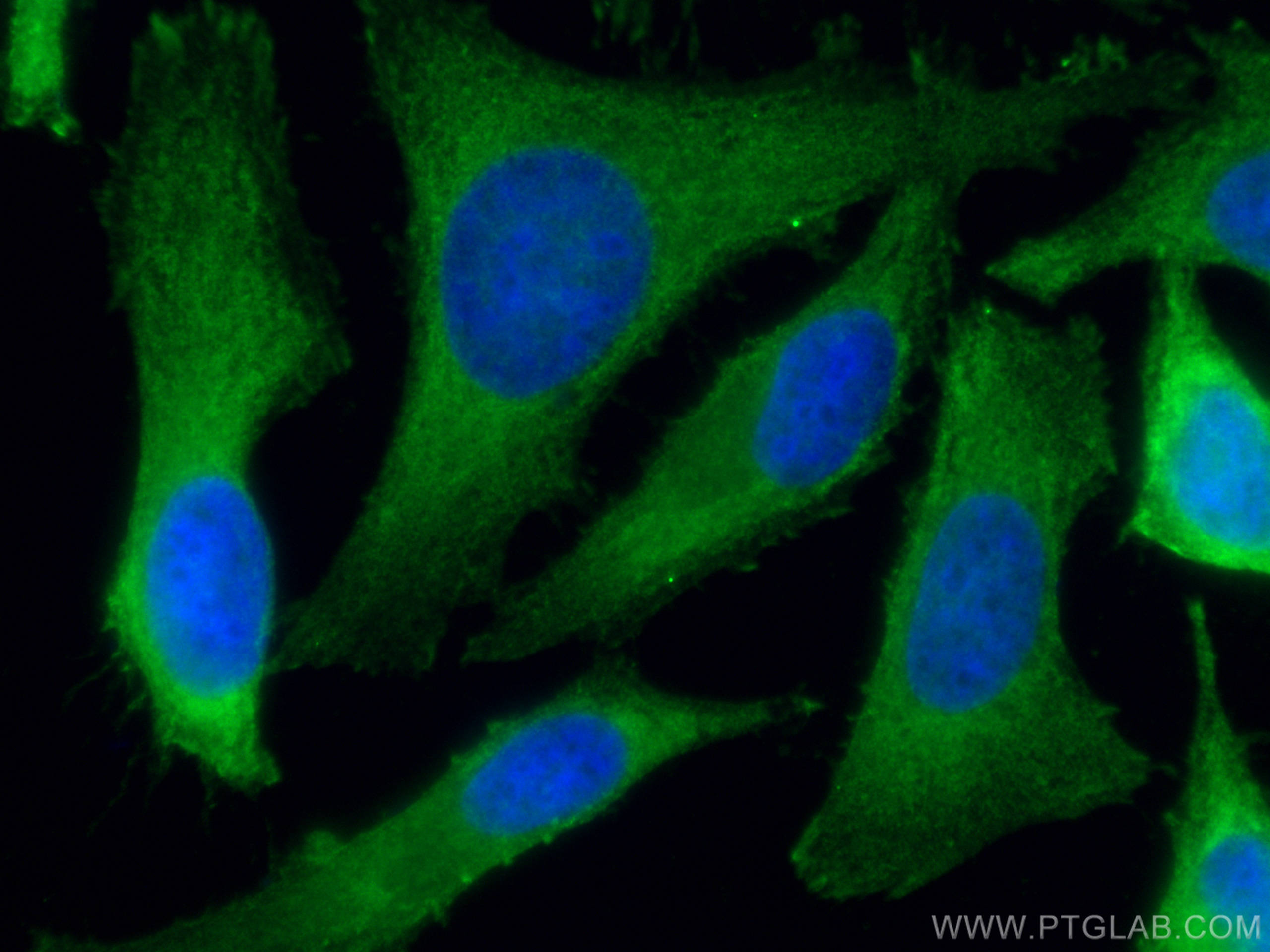 IF Staining of HeLa using 67591-1-Ig