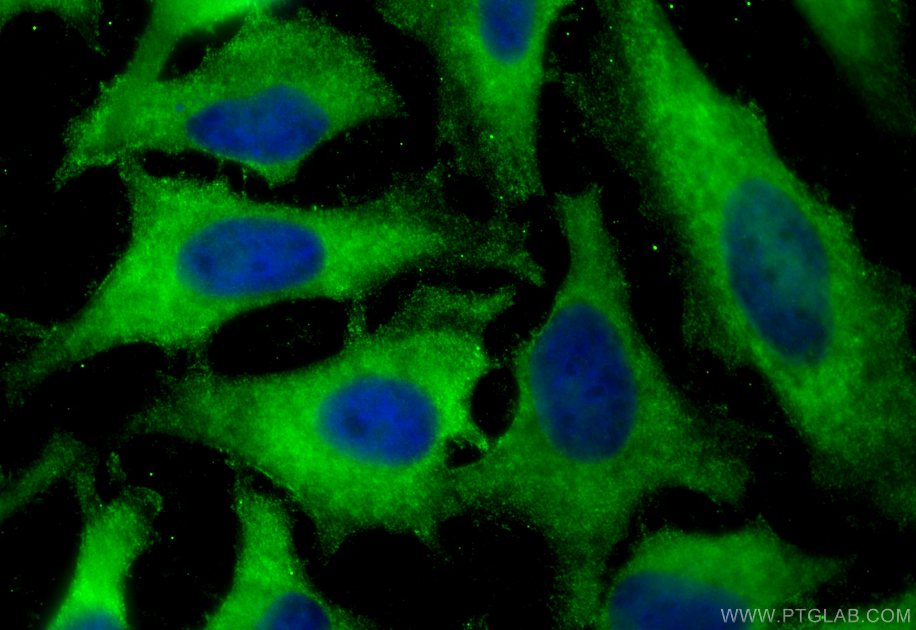 Immunofluorescence (IF) / fluorescent staining of HeLa cells using PHGDH Monoclonal antibody (67591-1-Ig)