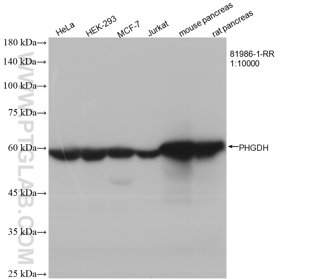 Western Blot (WB) analysis of various lysates using PHGDH Recombinant antibody (81986-1-RR)