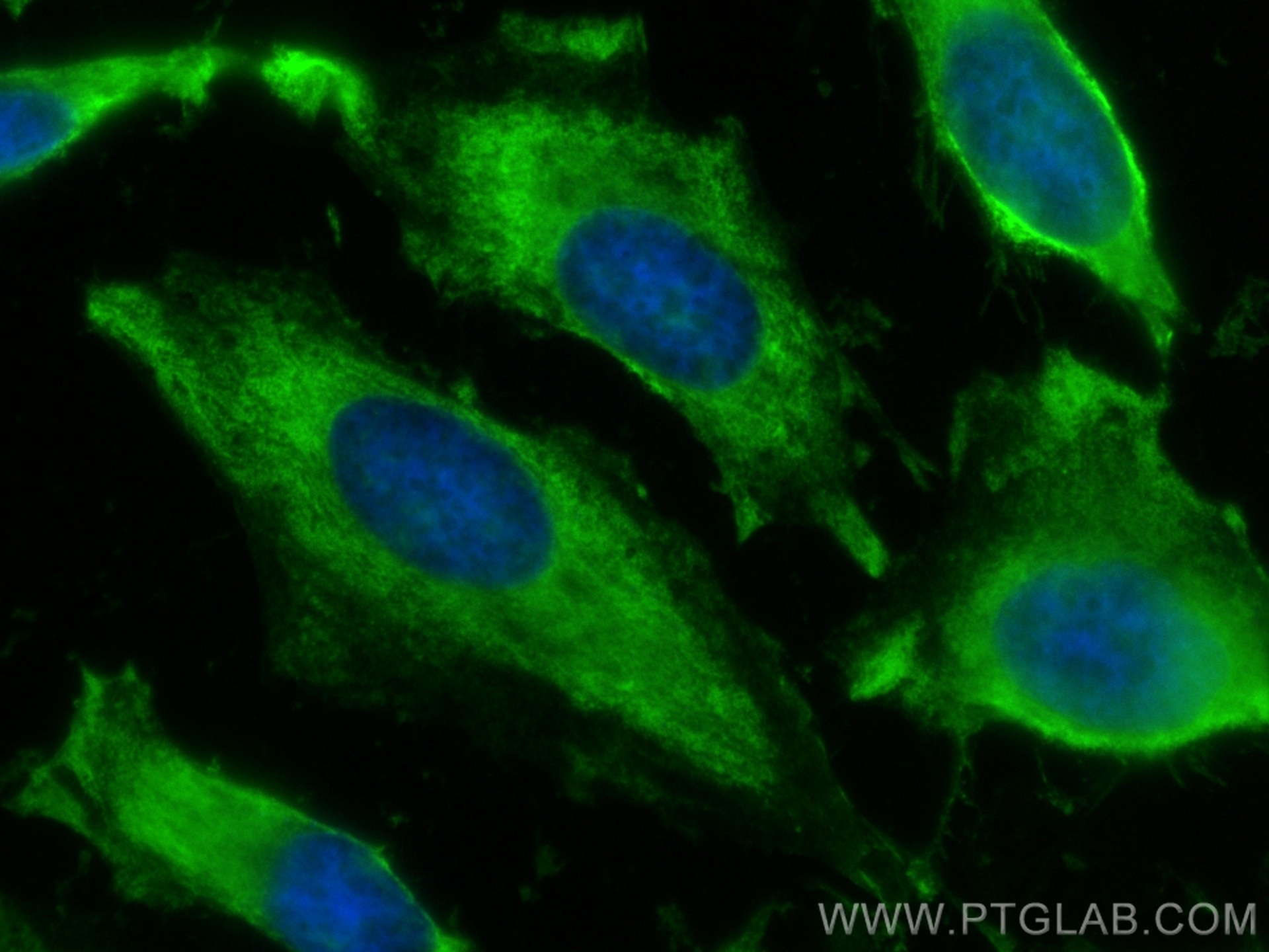 Immunofluorescence (IF) / fluorescent staining of HeLa cells using CoraLite® Plus 488-conjugated PHGDH Monoclonal ant (CL488-67591)