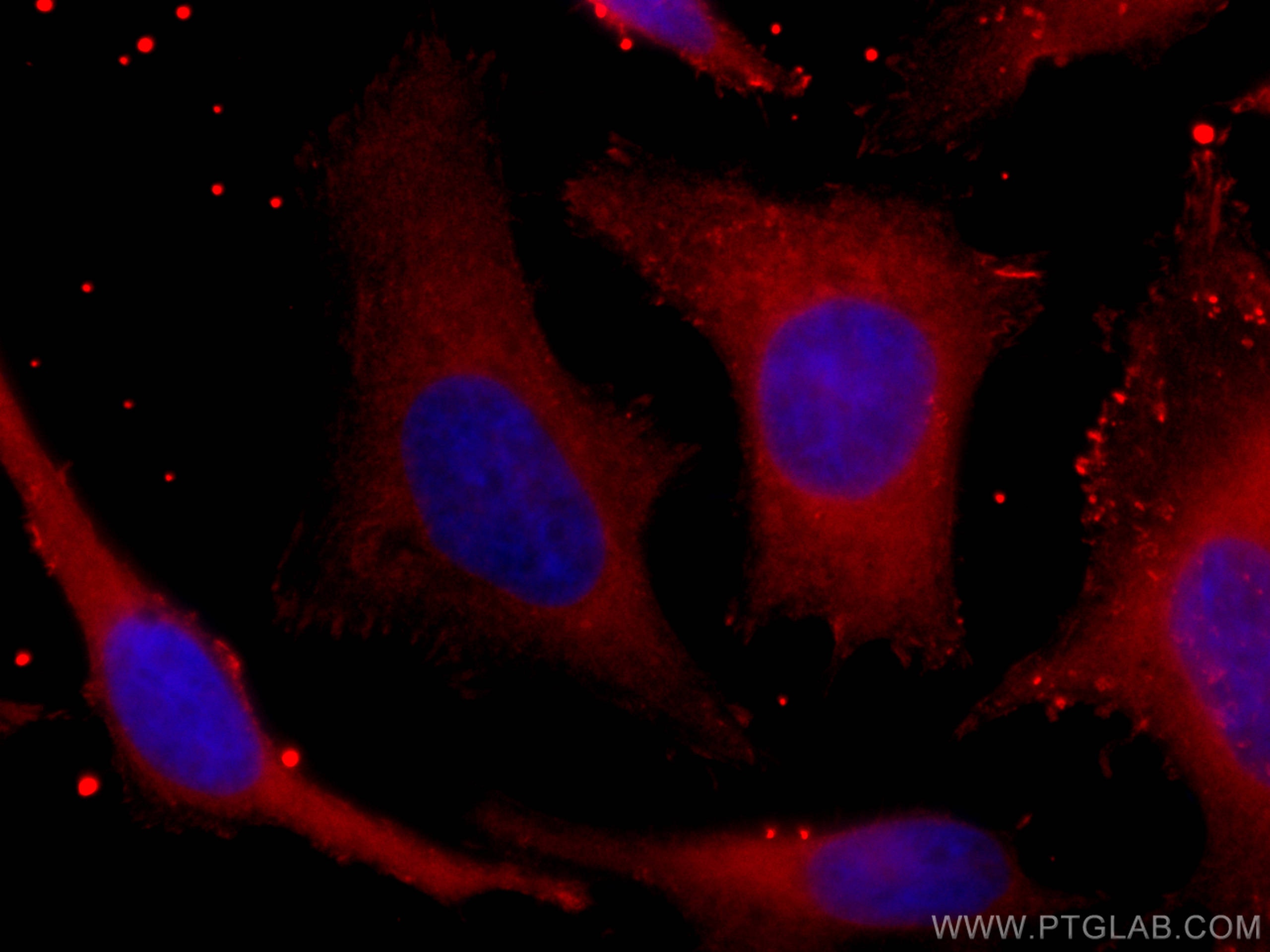 Immunofluorescence (IF) / fluorescent staining of HeLa cells using CoraLite®594-conjugated PHGDH Monoclonal antibody (CL594-67591)