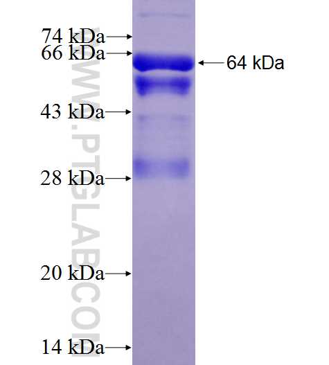 PHGDH fusion protein Ag6445 SDS-PAGE