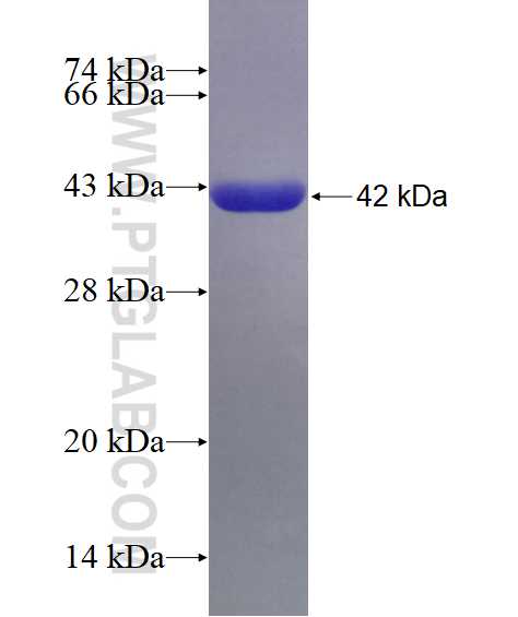 PHGDH fusion protein Ag6877 SDS-PAGE