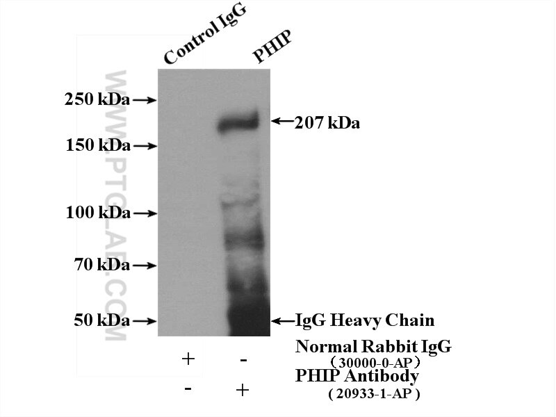 Immunoprecipitation (IP) experiment of A375 cells using PHIP Polyclonal antibody (20933-1-AP)