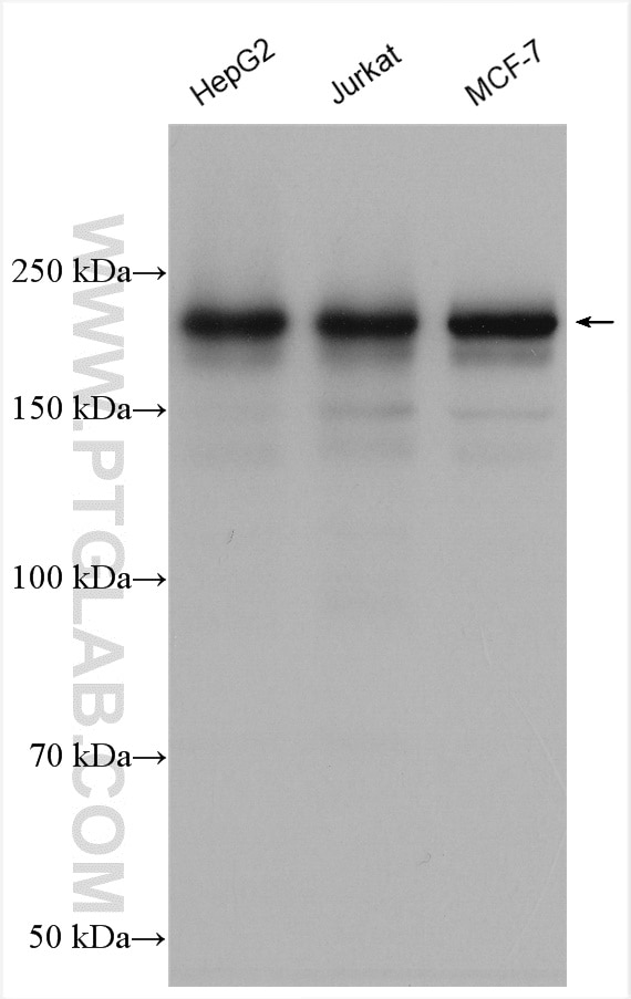 Western Blot (WB) analysis of various lysates using PHIP Polyclonal antibody (20933-1-AP)