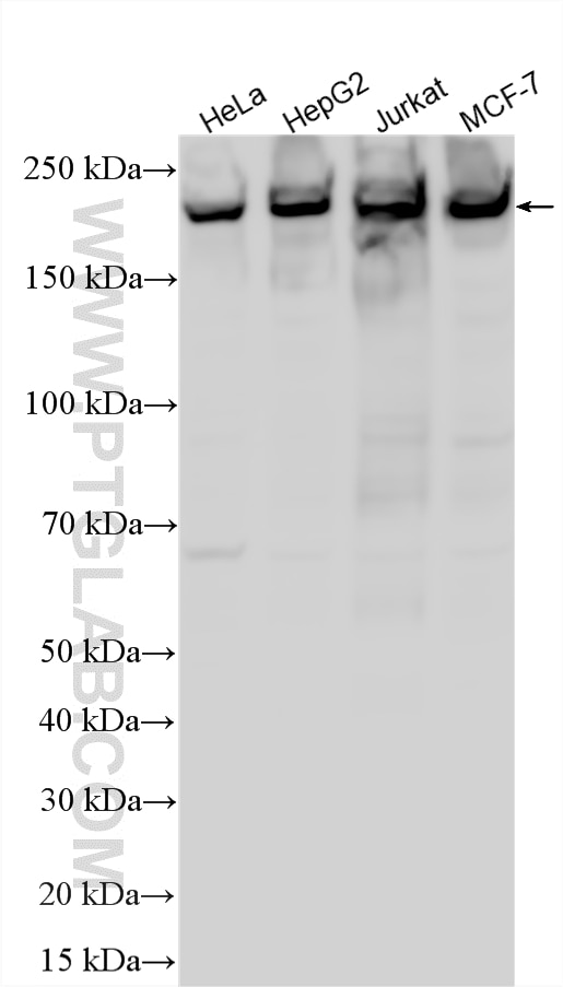 WB analysis using 20933-1-AP Western Blot (WB) analysis of various lysates using PHIP Polyclonal antibody (20933-1-AP)