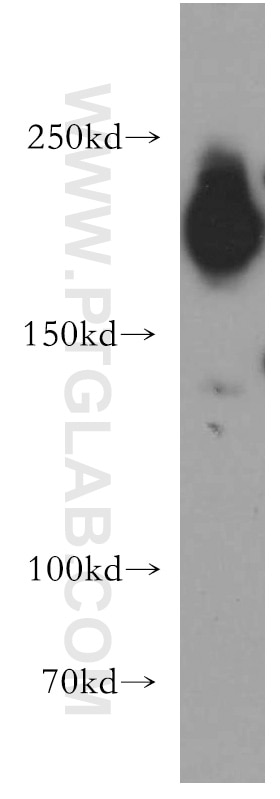 Western Blot (WB) analysis of A375 cells using PHIP Polyclonal antibody (20933-1-AP)