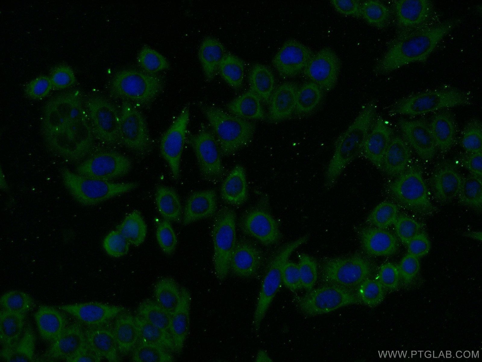 Immunofluorescence (IF) / fluorescent staining of HeLa cells using PHKA1 Polyclonal antibody (24279-1-AP)