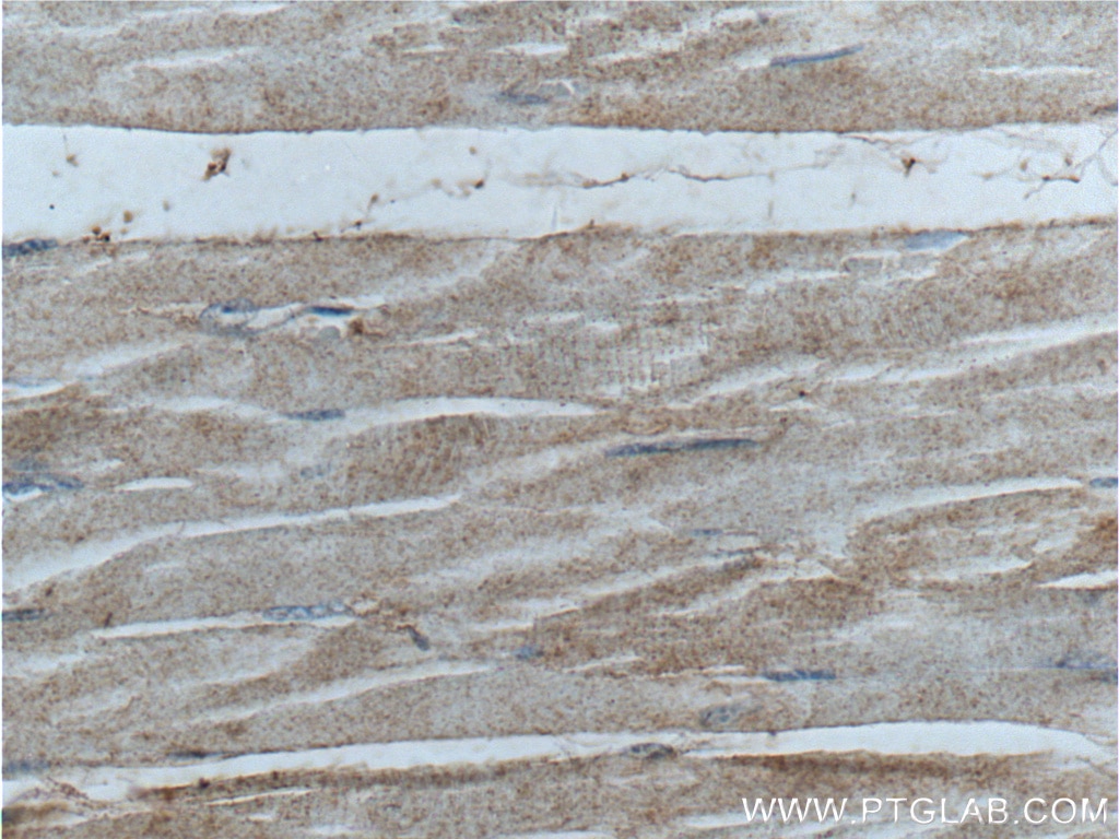 IHC staining of human skeletal muscle using 24279-1-AP