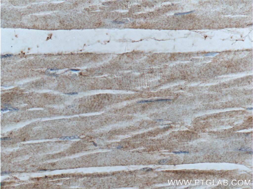 Immunohistochemistry (IHC) staining of human skeletal muscle tissue using PHKA1 Polyclonal antibody (24279-1-AP)