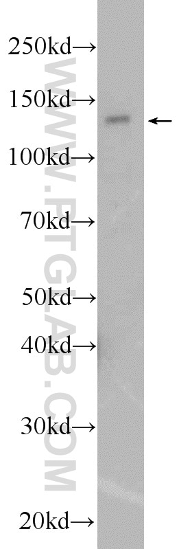 Western Blot (WB) analysis of mouse heart tissue using PHKA1 Polyclonal antibody (24279-1-AP)