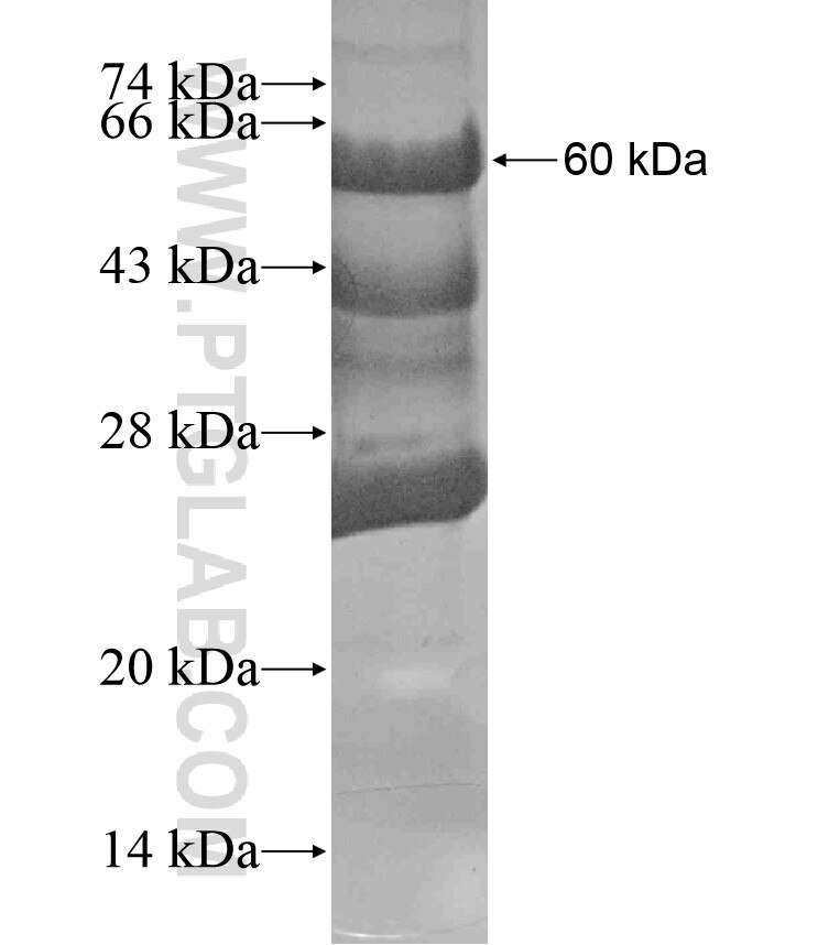 PHKA1 fusion protein Ag17998 SDS-PAGE