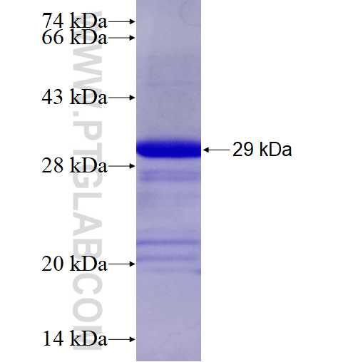PHKA1 fusion protein Ag19057 SDS-PAGE