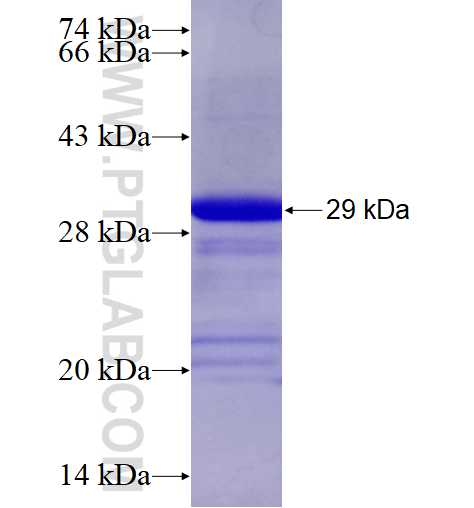 PHKA1 fusion protein Ag19057 SDS-PAGE