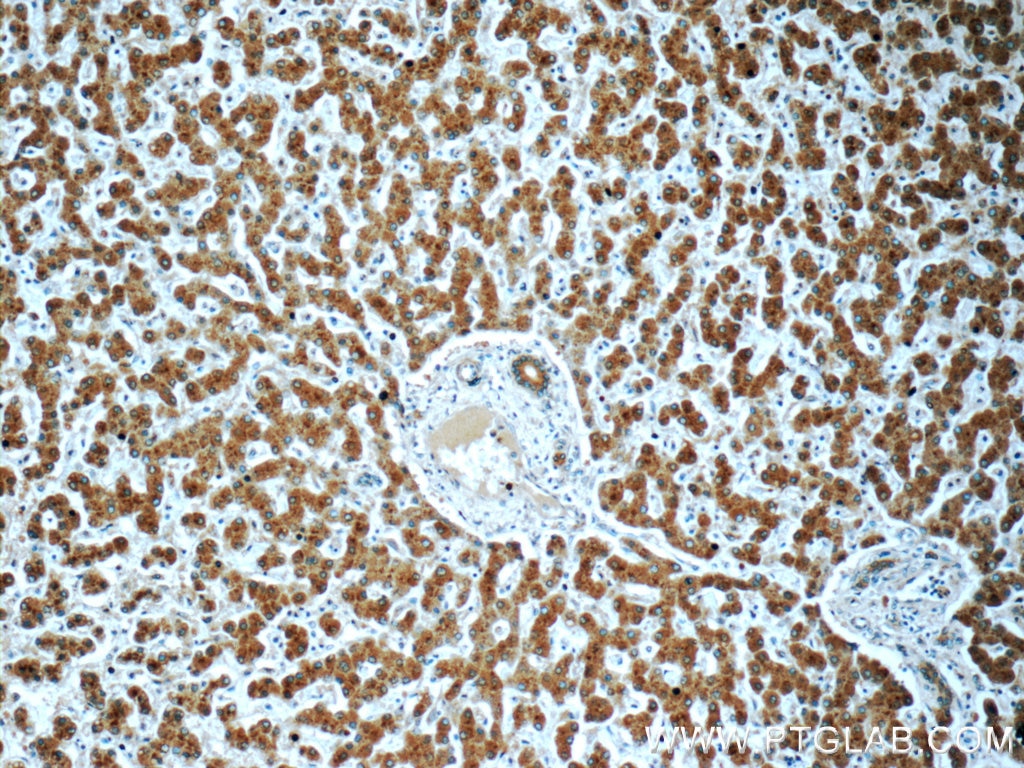 Immunohistochemistry (IHC) staining of human liver tissue using PHKA2 Polyclonal antibody (24658-1-AP)