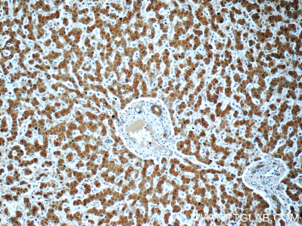 Immunohistochemistry (IHC) staining of human liver tissue using PHKA2 Polyclonal antibody (24658-1-AP)