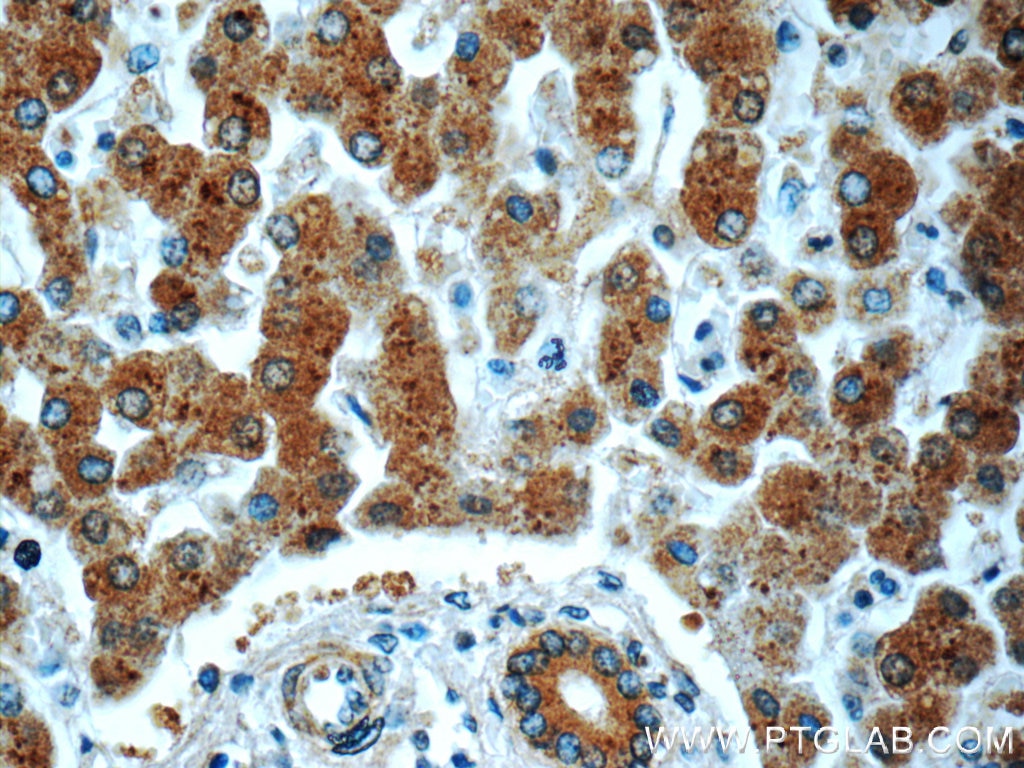 Immunohistochemistry (IHC) staining of human liver tissue using PHKA2 Polyclonal antibody (24658-1-AP)