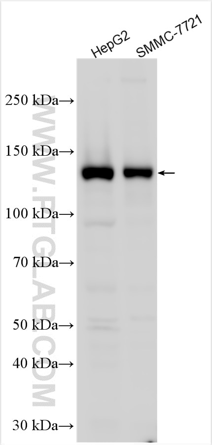 Western Blot (WB) analysis of various lysates using PHKA2 Polyclonal antibody (24658-1-AP)